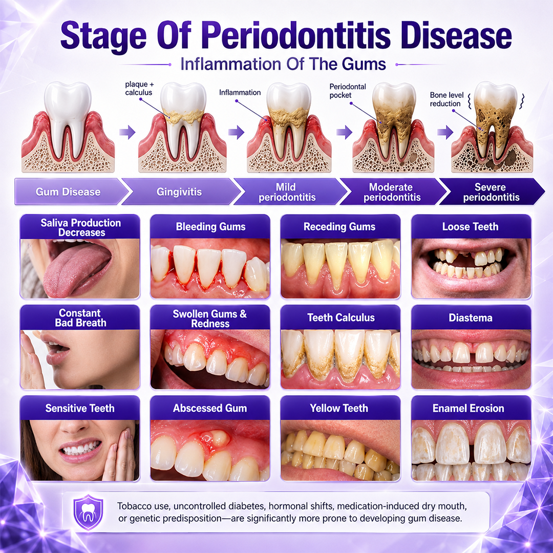 ZORVL™ Gingivitis Periodontal Treatment Toothpaste