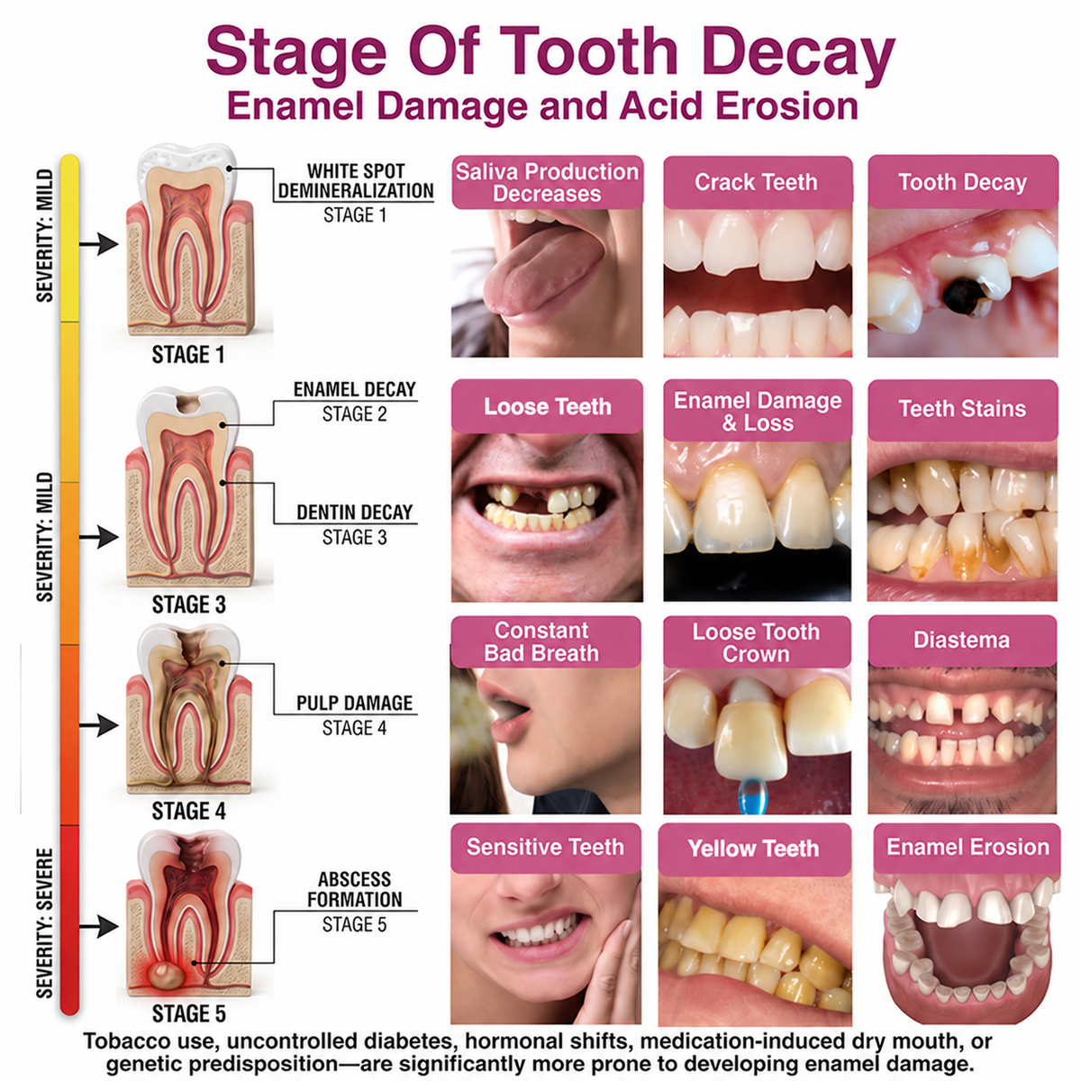 🇺🇸Roliney® DenPerm Cavity-Repair Natural Enamel Filling Gel