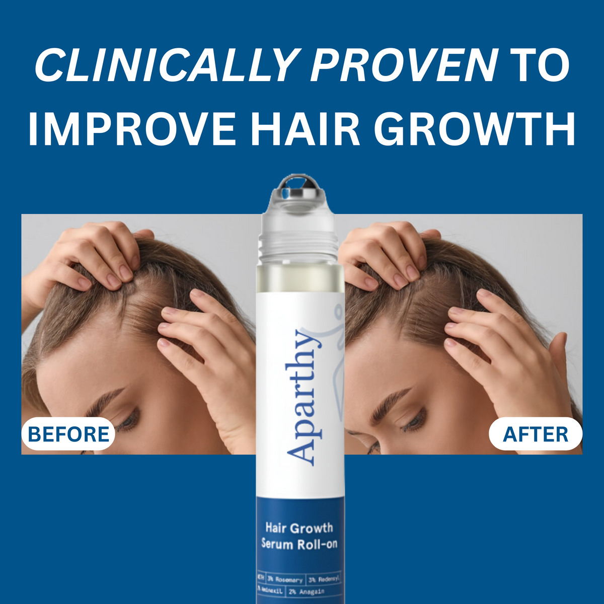 Aparthy Hair Growth Roll on Serum
