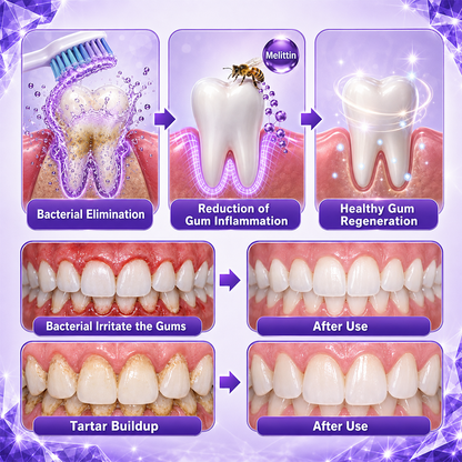 ZORVL™ Gingivitis Periodontal Treatment Toothpaste
