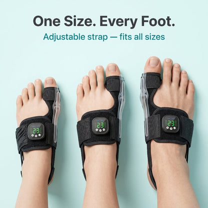 🏆ZORVL™Nexalign Pro - EMs Bunion Corrector