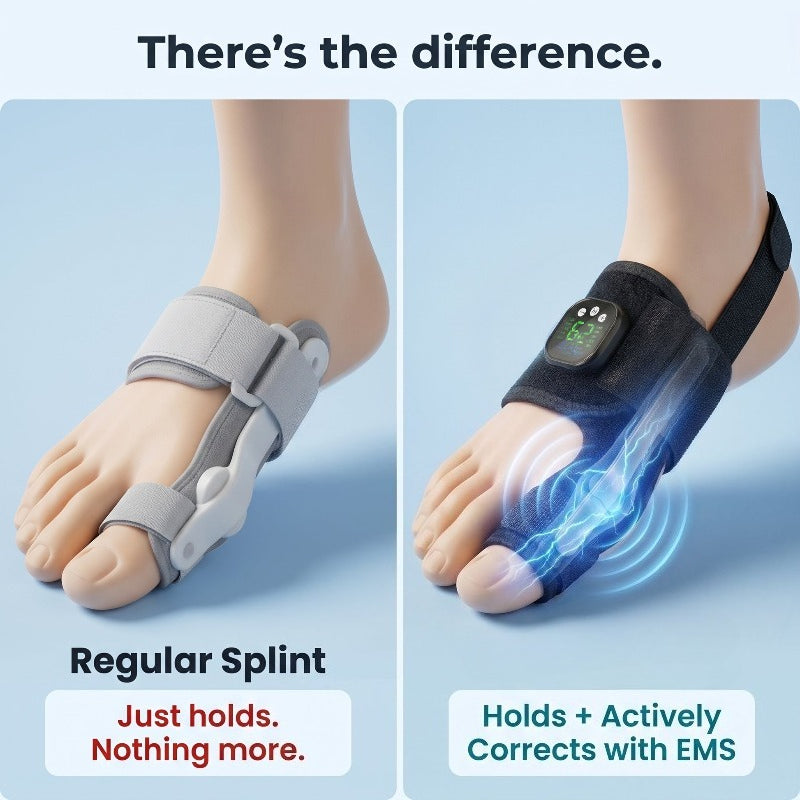 🏆ZORVL™Nexalign Pro - EMs Bunion Corrector
