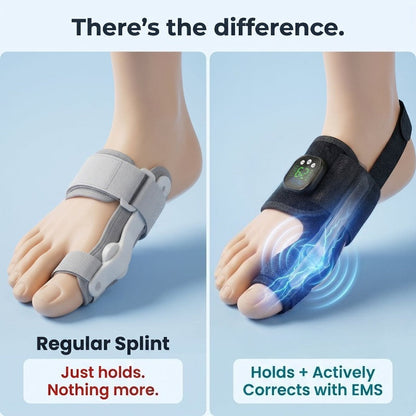 🏆ZORVL™Nexalign Pro - EMs Bunion Corrector